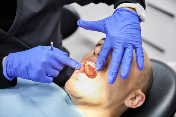 Best Dentist for Tooth Abscess  in Crowley, TX